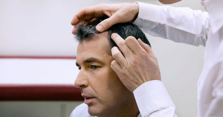 Men’s Hair Restoration Guide