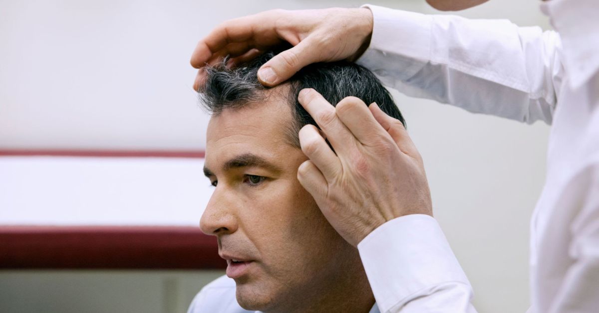Men’s Hair Restoration Guide