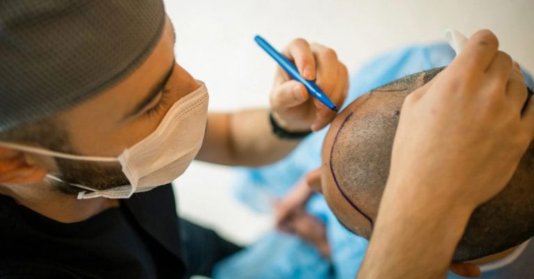 Hair Transplant Cost by Country
